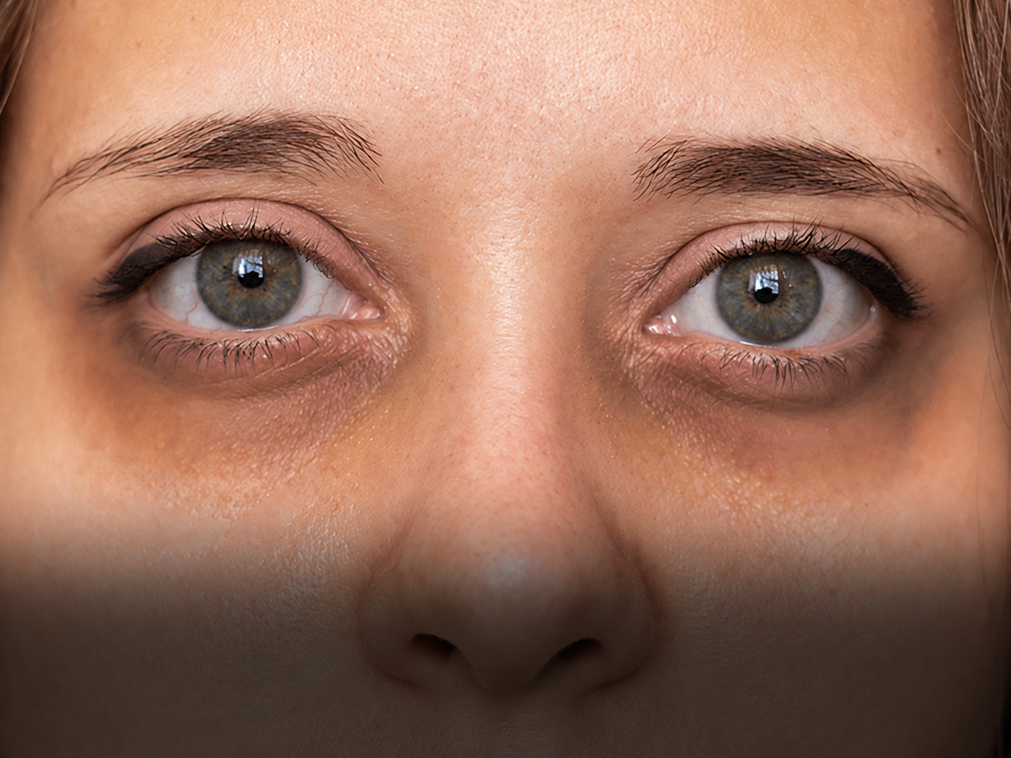 Dark Circles