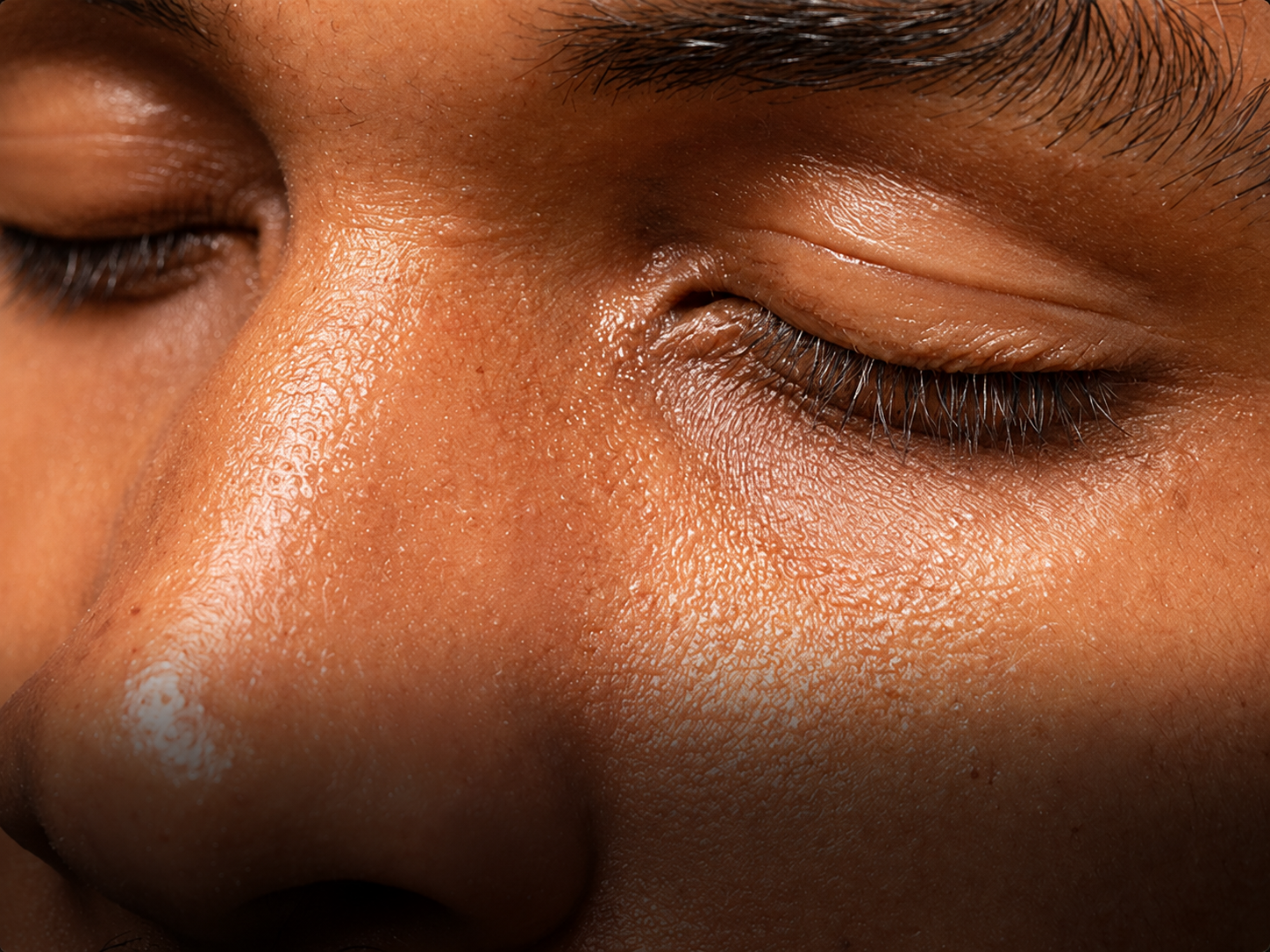Oily Skin