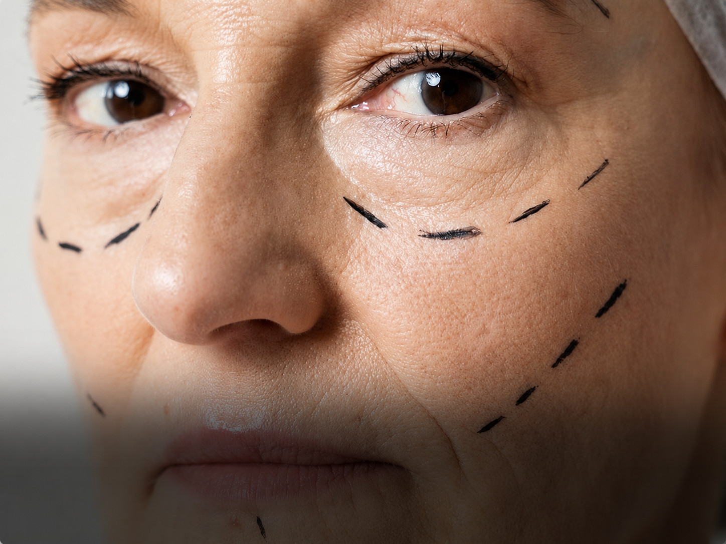 Wrinkles And Fine Lines